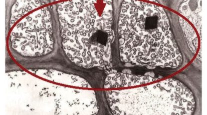 بكتيريا الفيتوبلاسما تظهر في الخلايا العلوية لهذه النبتة بمساعدة ميكروسكوب إلكتروني copy