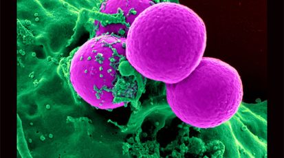 بكتيريا ستافيلوكوكس مقاومة للميثيسيلين أحد أقوى المضادات الحيوية1